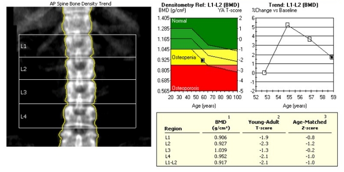 CP Advanced Imaging | Bone Densitometry